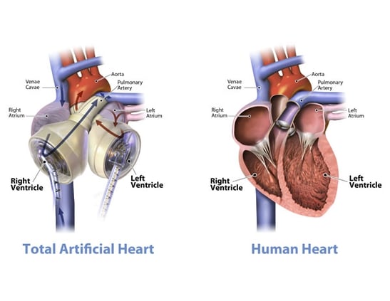 Artificial Heart - syncardiawithlabels