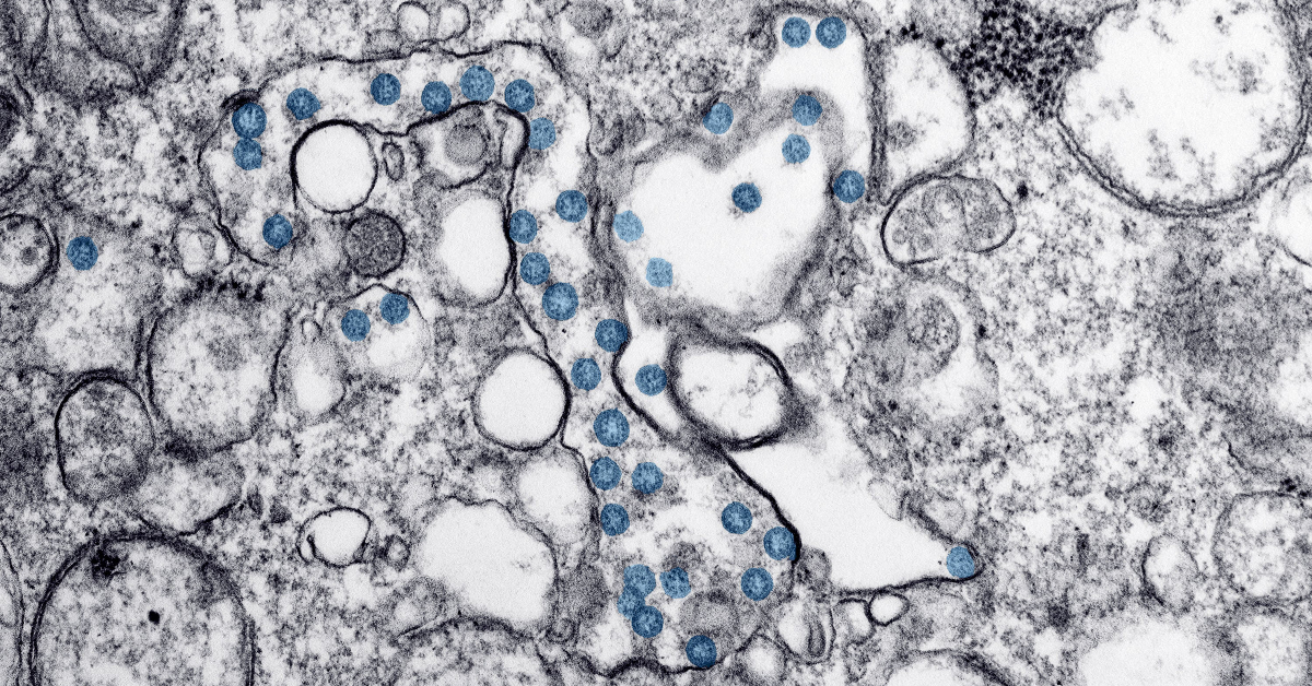 A*STAR and MiRXES step up in the fight against coronavirus (COVID-19)